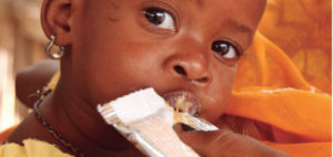 Desnutrición infantil – Derecho a la supervivencia